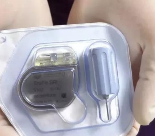 心臟起搏器：為生命續(xù)航的科技力量