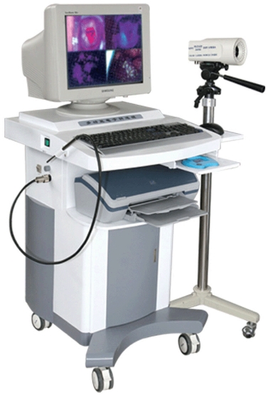 電子陰道鏡：女性健康，私密檢查的得力助手