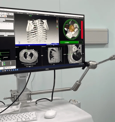 激光手術(shù)導(dǎo)航的便攜時代：精準定位，引領(lǐng)手術(shù)新潮流