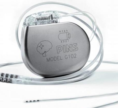 神經(jīng)調(diào)控的新篇章：深部腦刺激器（DBS）為帕金森病患者帶來的希望