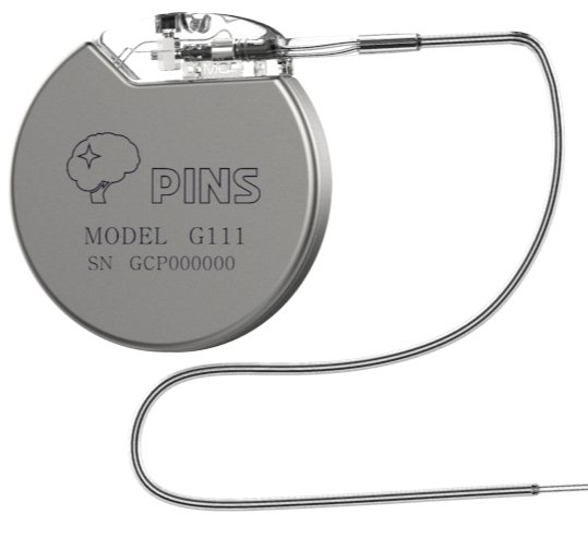 精準(zhǔn)神經(jīng)調(diào)控的未來：迷走神經(jīng)刺激器（VNS）在癲癇治療中的進(jìn)展