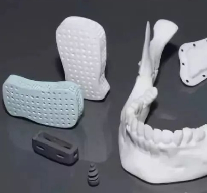 個(gè)性化骨科修復(fù)的創(chuàng)新：3D打印生物陶瓷植入物的應(yīng)用與發(fā)展