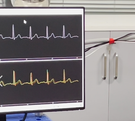 無創(chuàng)心臟監(jiān)測(cè)新工具：穿戴式心沖擊圖（BCG）設(shè)備全天候監(jiān)控心臟健康