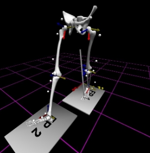 智能康復(fù)訓(xùn)練的新伙伴：虛擬現(xiàn)實(shí)（VR）結(jié)合步態(tài)分析系統(tǒng)助力患者恢復(fù)行走能力
