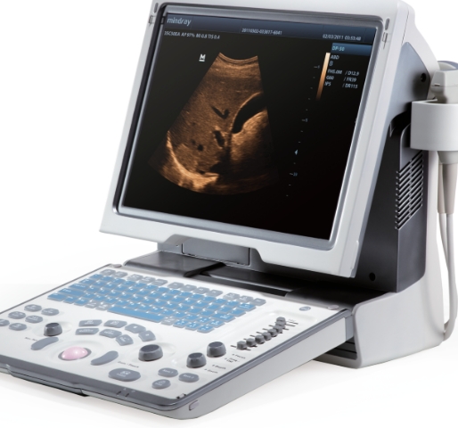 便攜式超聲設(shè)備：革新醫(yī)療影像的未來