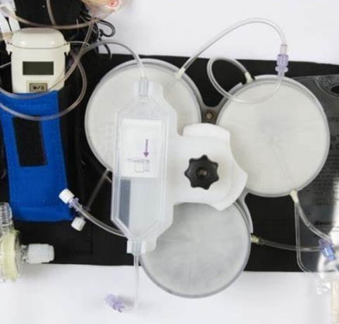 可穿戴式腎透析設(shè)備：為患者提供更多的自由和舒適