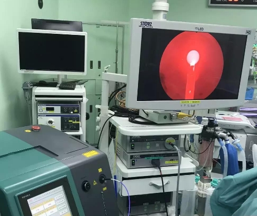 光動(dòng)力療法設(shè)備：針對(duì)癌癥的非侵入性治療方案