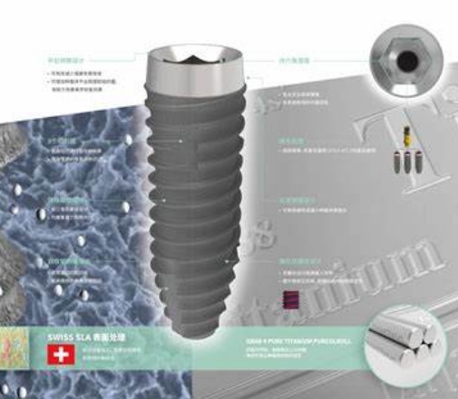 種植系統(tǒng)：全面解決方案的人工牙齒種植系統(tǒng)，促進口腔健康恢復(fù)