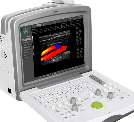 乳腺X光機(jī)：專(zhuān)為乳腺癌早期檢測(cè)設(shè)計(jì)的高分辨率乳腺X線(xiàn)攝影設(shè)備