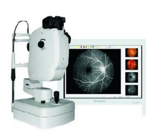 眼底熒光造影機(jī)