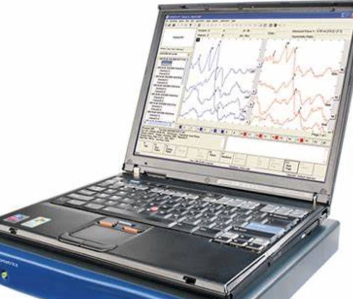 聽(tīng)力誘發(fā)電位測(cè)試儀