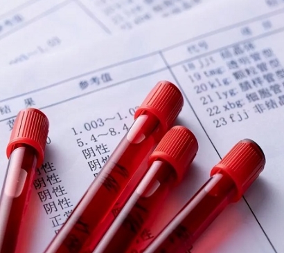 性激素六項(xiàng)分析儀