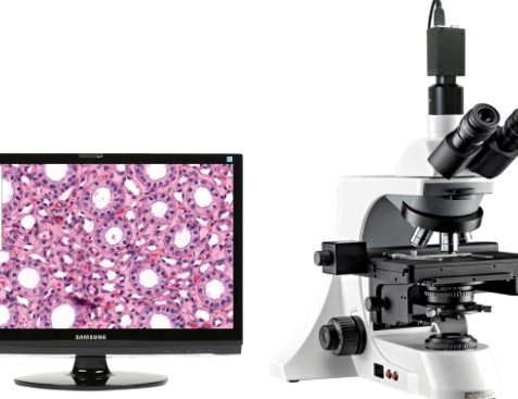 數(shù)字病理診斷系統(tǒng)?